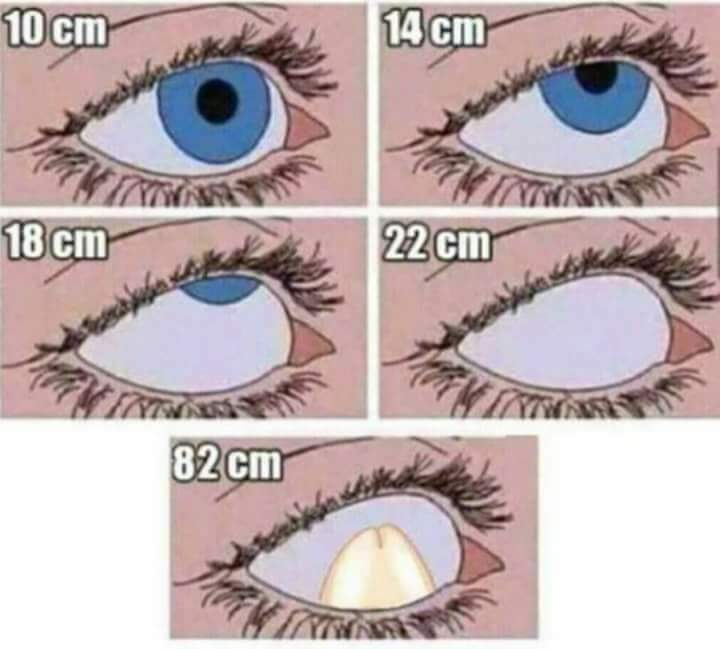 LgSsXq9.jpg