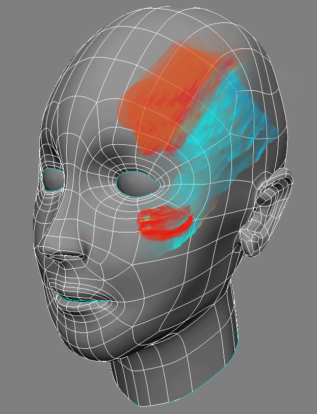 migraine-gif-21.gif