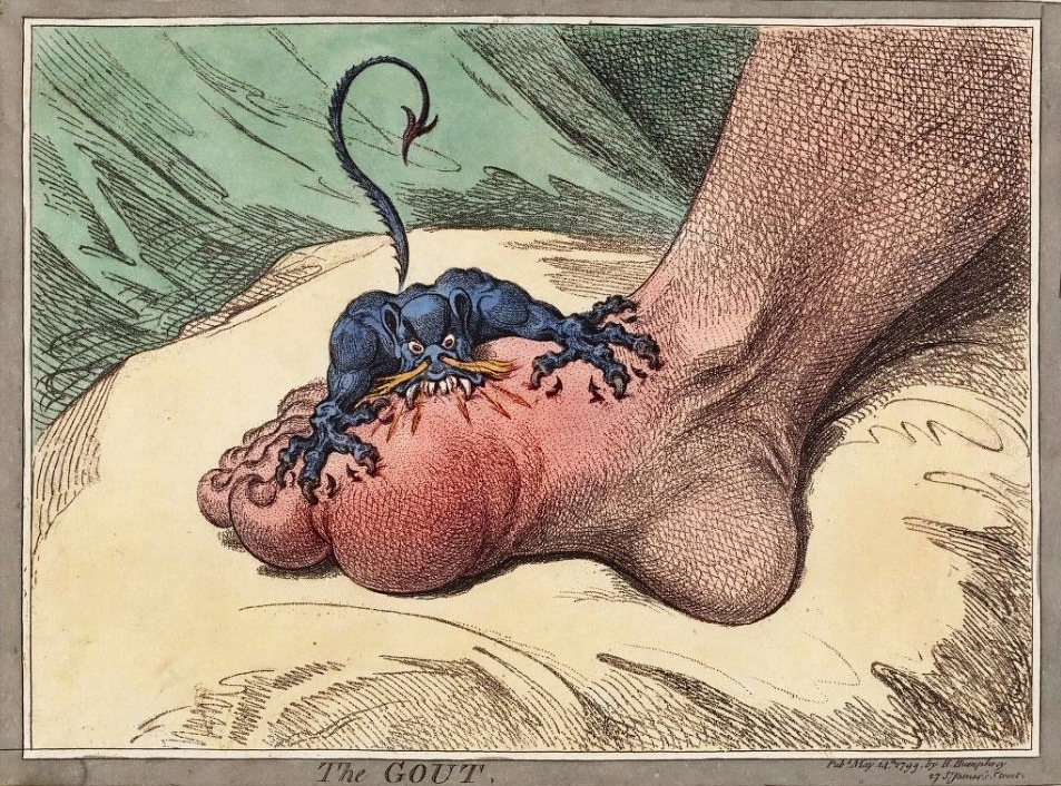 The_gout_james_gillray.jpg